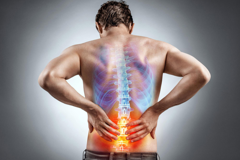 Understanding Scoliosis and the Impact of Chiropractic Adjustments